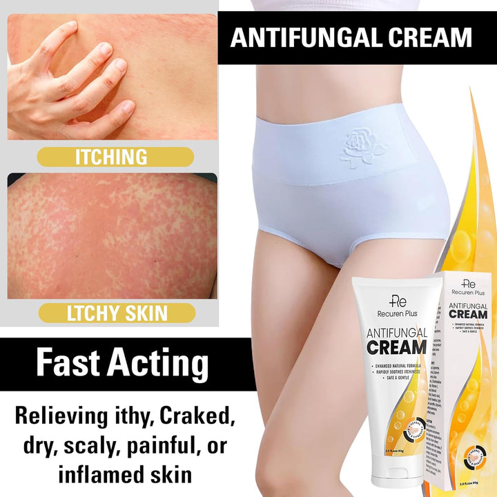 Antifungal Herbal Skin Care Cream: Daily Comfort for Athlete’S Foot, Jock Itch & Ringworm – Gentle, Nourishing and Hydrating 60G