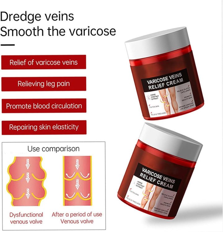 80G Varicose Veins Relief Cream, Varicose Veins Treatment for Legs, Varicose Veins Cream Vein Relief Cream Varicose Veins Treatment Cream for Legs Aching Legs Relief, Spider Veins Repair Cream