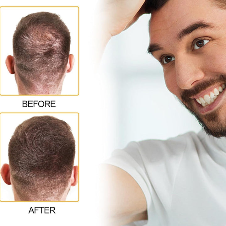 Hair Care Concealer, Women'S Hair Concealer, Create Volumizing Hair, Suitable for Men and Women, Natural and Long-Lasting