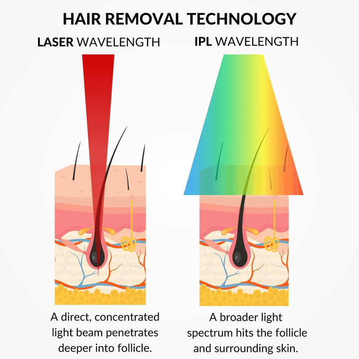 Skin Laser Hair Removal Device | at Home Hair Removal Treatment, Clinic Technology at Home, Full Body Hair Reduction for Underarms, Legs, Bikini, Feet, Hands, Chest, Back & Stomach