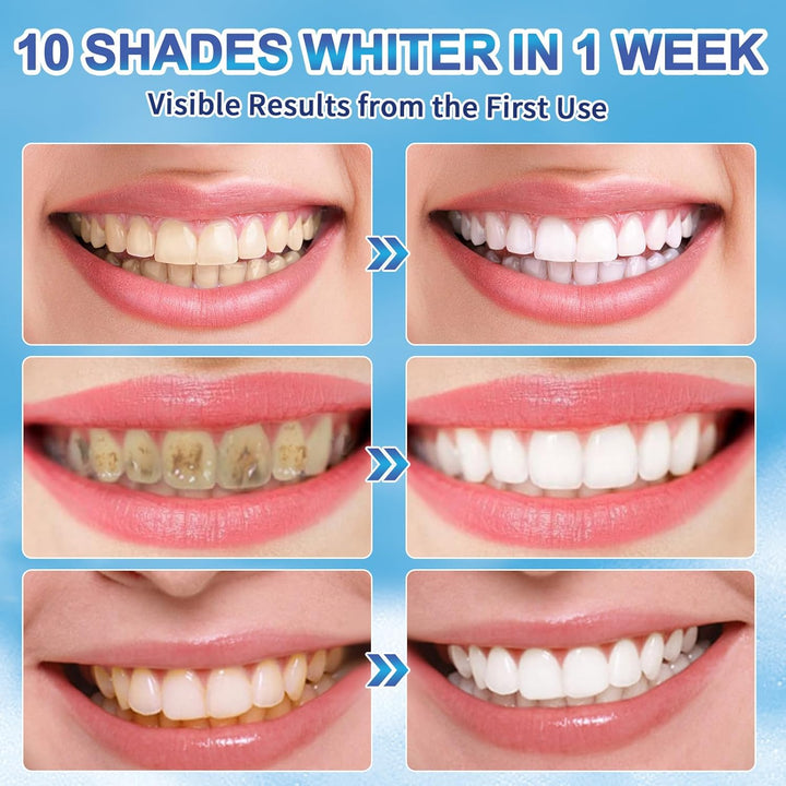 Teeth Whitening Pen(4 Pens), Teeth Whitening Kit for Bright Teeth, No Sensitivity Teeth Whitening Gel, Dental Brightening Tooth Whitener Pen, Instant Effective Teeth Whitener Removes Years of Stains