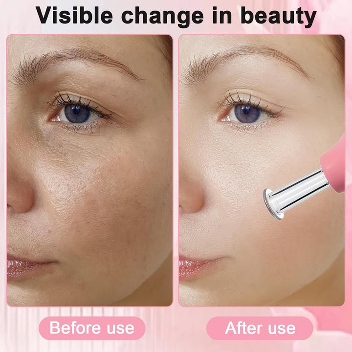 3Pcs Facial Cupping Set, 3 Sizes Silicone Facial Cupping Set for Face, Neck, Back, Eyes Massage Vacuum Cup Suction