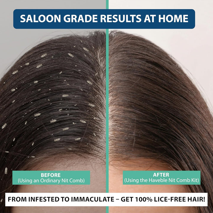 Professional 6-In-1 Nit & Lice Comb Kit | Micro Spiral, Precision & 2× Double-Sided Combs | Brush, Tracker & EVA Case | Reusable, Chemical-Free | for Kids, Adults, Pets (All Hair Types)