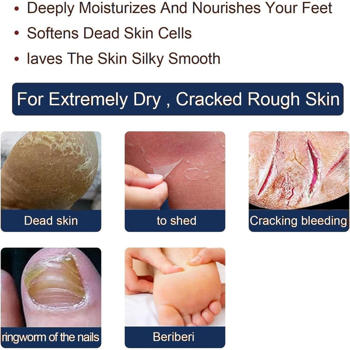 2PCS Athletes Foot Treatment,Anti Fungal Skin Cream,Antifungal Cream for Effective Anti-Itch,Itch Relief Cream,Foot Fungus Treatment,Itchy Skin Relief for Adults,Athletes Foot Cream Extra Strong