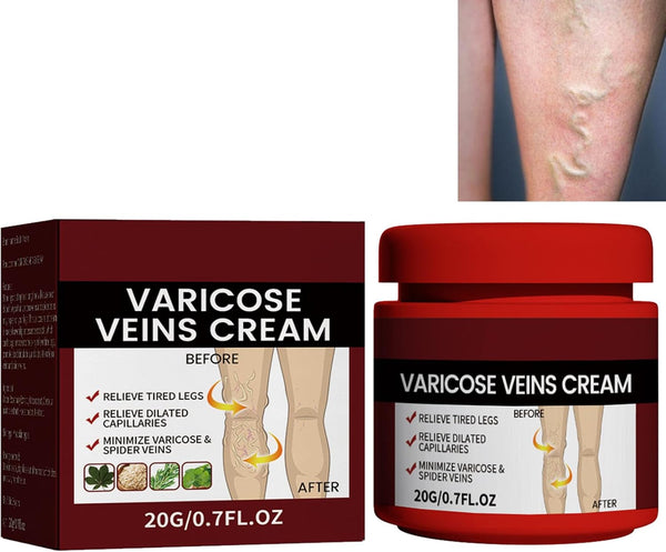 Cream for Varicose Veins in Legs,Varicose Veins Cream,Vein Relief Cream,Vein Cream for Legs,Varicose Veins Treatment Cream,Varicose Vein Removal Cream,Improve Blood Circulation,20G,1Pc