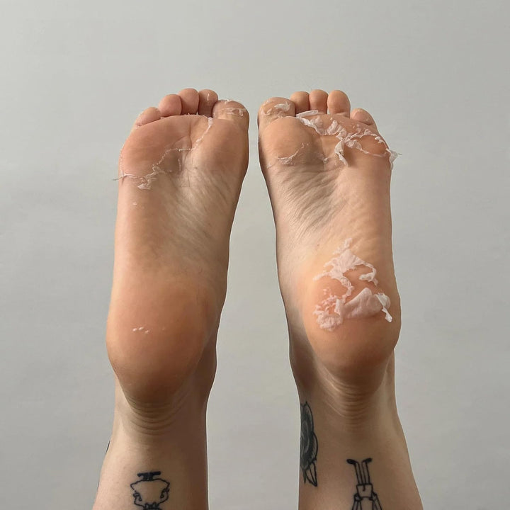 Foot & Callus Peel Mask Exfoliating Socks for Cracked Heels & Dead Skin Vegan Foot Care for Soft, Smooth Feet Multi Award Winning Brand