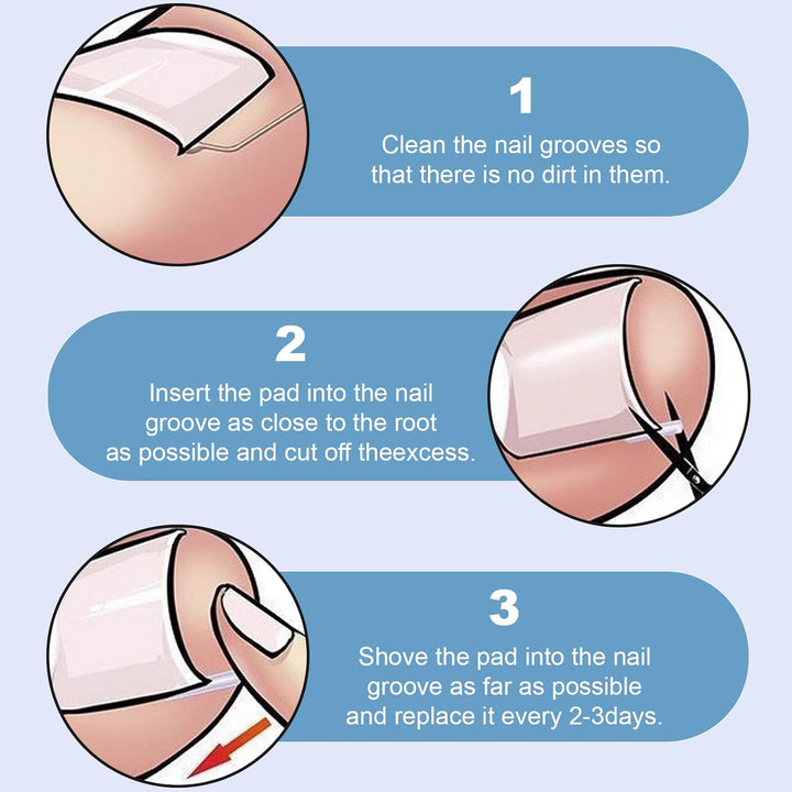 50 PCS Ingrown Toenail Corrector Set - Pain-Free Toenail Straightener Strips with Lifter Tool - Easy Use Foot Care Kit for Men & Women