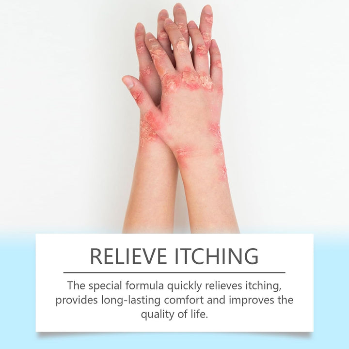 Antifungal Cream - anti Fungal Skin Cream - Ringworm, Jock Itch, Eczema, Tinea Versicolor, Athletes Foot Treatment - Fast Acting & Gentle Safe & Soothing Hydrating Formula