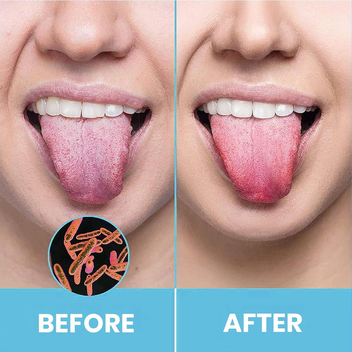 Tongue Scraper for Adults by  (2Pcs Oral Care Pack) Stainless Steel Tongue Cleaners Reduce Bad Breath 100% Metal Tough Scrapers Men and Women Hygiene Product