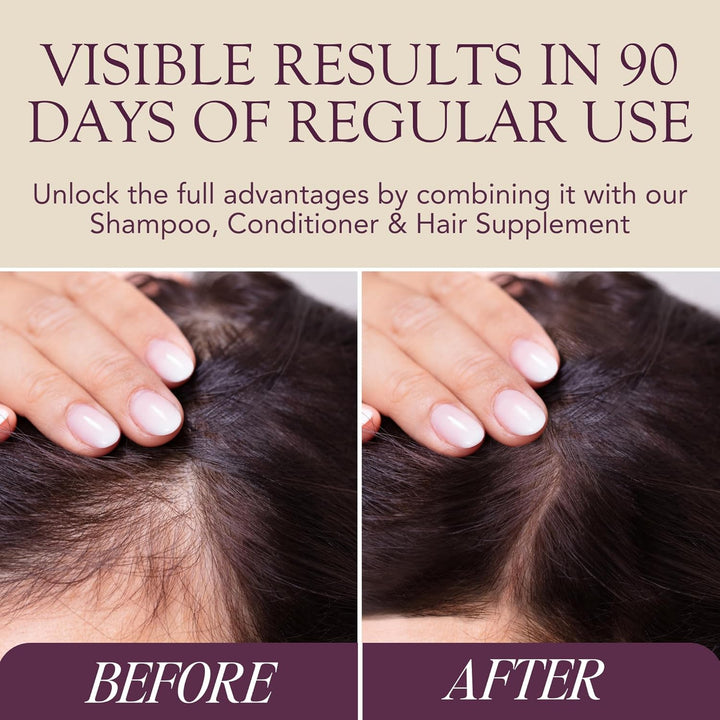 WELLNESS Stimulating Hair Growth Serum – Natural Minoxidil Alternative with Caffeine, Biotin, Anagain™, Capilia Longa™ – Clinically Tested Solution for Thinning Hair - Men & Women (50Ml)