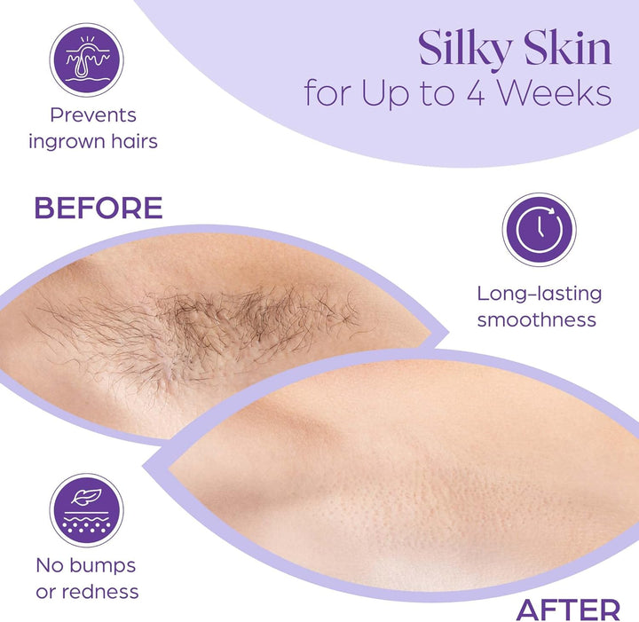 Fleece Strips for Warm Wax and Sugar Paste [Pack of 150] Skin-Friendly and Tear-Resistant Hair Removal Strips Made of Fleece for Any Type of Depilation on Leg, Chest, Back, Intimate Area and Face