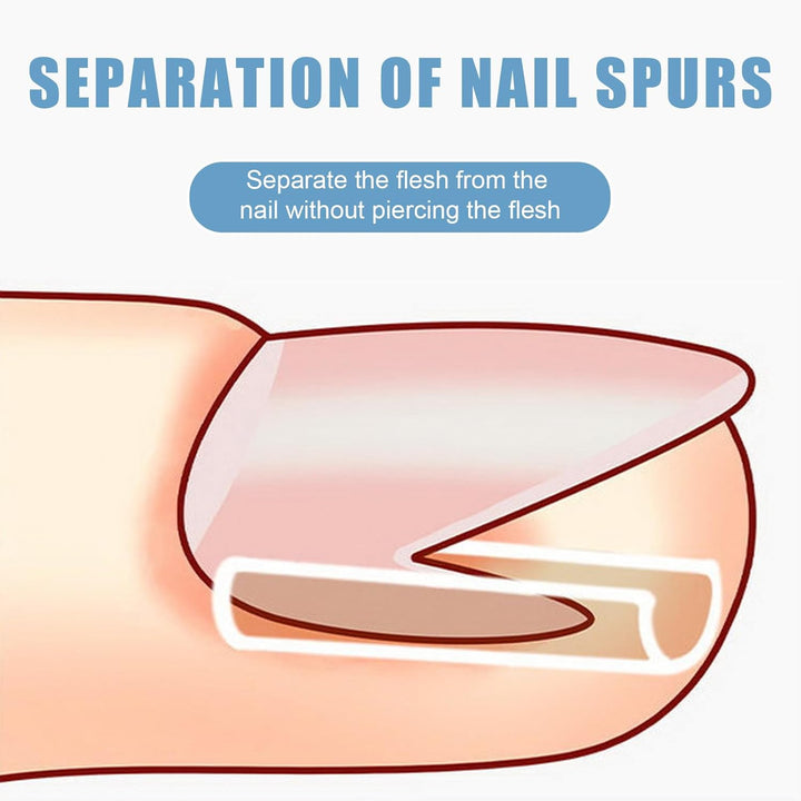 50 PCS Ingrown Toenail Corrector Set - Pain-Free Toenail Straightener Strips with Lifter Tool - Easy Use Foot Care Kit for Men & Women