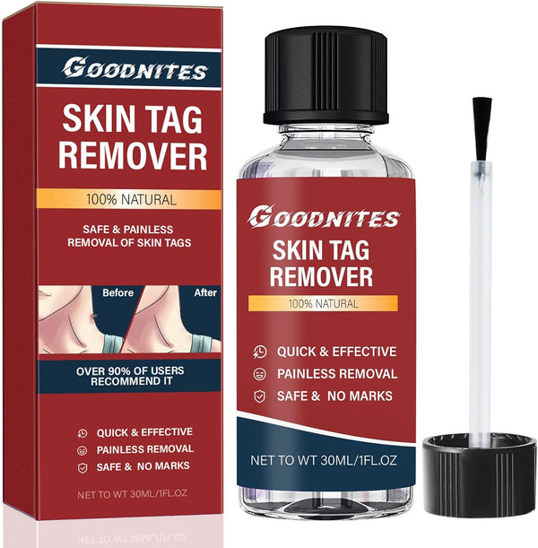 Fast-Acting Skin Tag Removal Kit, Natural and Gentle Formula, Zero Pain Skin Tag Remover, Suitable for Neck, Underarms, Groin, Trusted by the Whole Family, 30ML