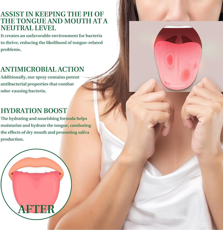 Tongue Repair Spray, Oral Antibacterial Spray, Instant Dry Mouth Relief, Fissured Tongue-Relief Sprays, Mint Breath Freshener Sprays, Tongue Repair-Spray for Dryness, White Coating and Bad Breath