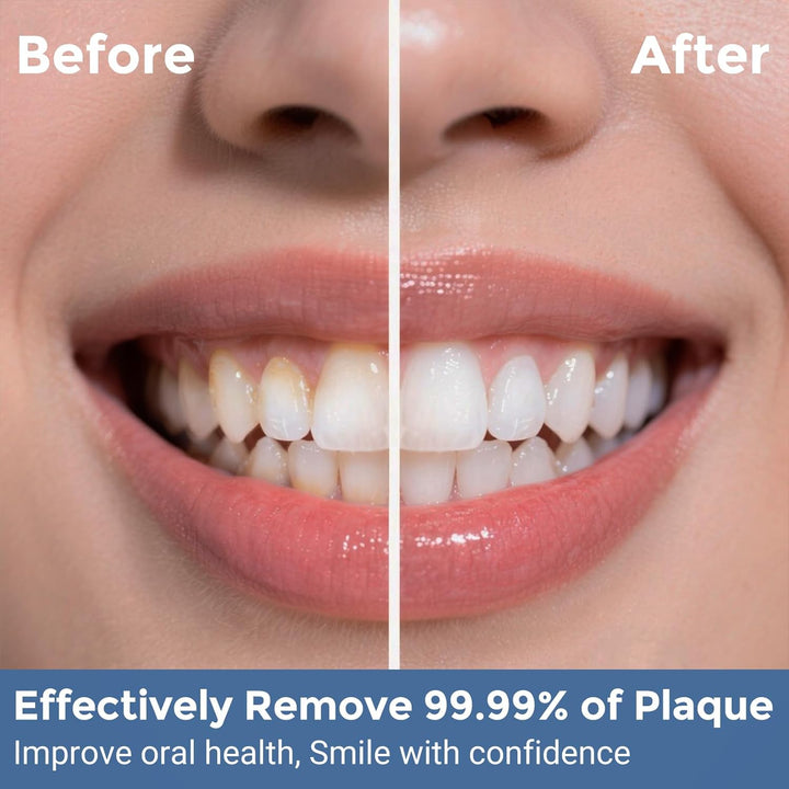 Water Flosser for Teeth: Portable Travel Flossers Set for Teeth Cleaning with 5 Modes, Cordless Dental Electric Flosser for Oral Care, Rechargeable Floss DIY Mode IPX7 Waterproof