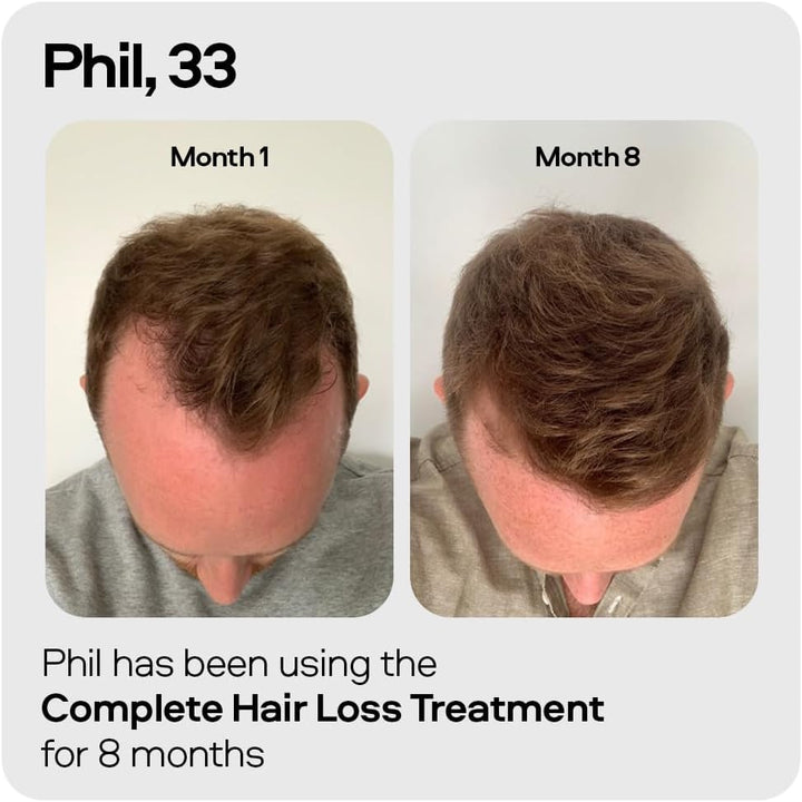 Hair Growth Shampoo for Men. DHT Blocker. Thickening Formula Promotes Strong & Thick Regrowth. Contains Saw Palmetto, Argan Oil, Caffeine, & Rosemary. 3 Month Supply. Made in Europe.