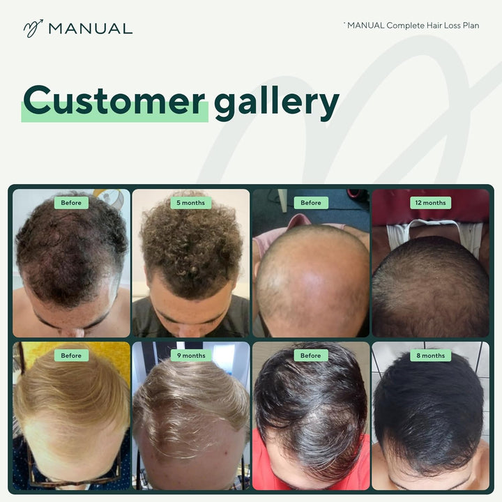 Biotin, Saw Palmetto & Caffeine Hair Growth  Shampoo for Men (200Ml) – Natural Formula to Stimulate & Revive Follicles – Use Daily to Support & Maximise Regrowth & Hair Health