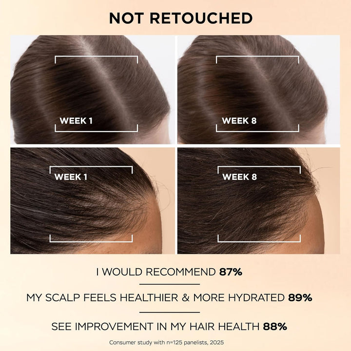 Grow Abundant Anti-Hair Loss Scalp Serum Treatment 60Ml. Grow Thicker, Fuller, Longer, Denser Hair in 8 Weeks. Increase Density & Reduce Hair Loss. with 3000 Pro-Vitamin Complex & Niacinamide