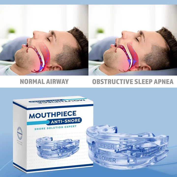 Anti Snoring Mouthpiece: anti Snoring Devices for Men and Women Snore Stopper for Sleep,Adjustable Sleep Mouthpiece