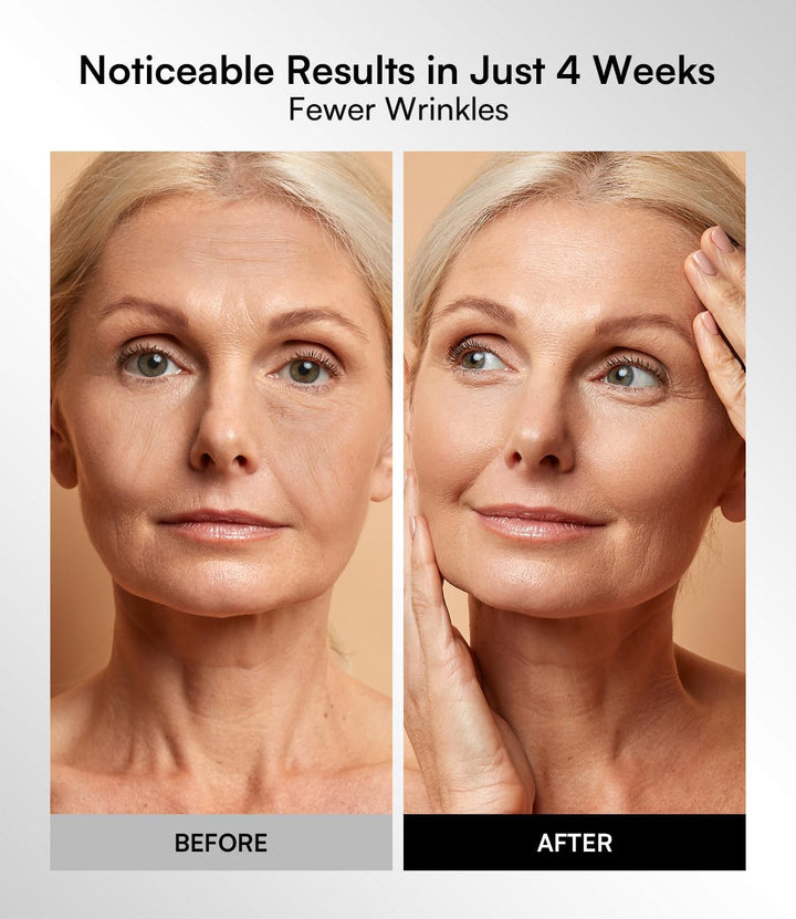 LED Face Mask – Red Light Therapy Mask with 4 Light Modes, 850Nm NIR, Red & Blue Led Mask Light Therapy, 220 Beads, Rechargeable Infrared Mask Wavelength for Acne, Anti-Ageing, Skin Care, Wrinkle