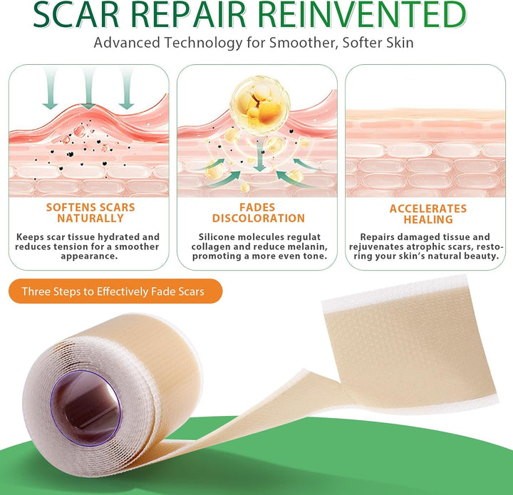 Silicone Scar Tape, Medical Grade Silicone Scar Sheets (1.6" X 75"-1.9M), Professional Scar Removal Treatment, Reusable Scar Tape for Healing Keloids, Surgeries Scars, C-Sections and Burns