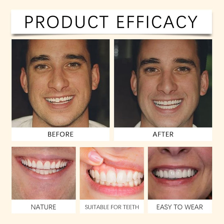 Advanced Full Denture Set,Silicone Reline Denture Set for Women,Soft Denture Reline Kit,Silicone Soft Dentures Repair,Snap on Veneers Teeth Upper & Lower,Silicone Dentures Full Mouth,Full Denture Set