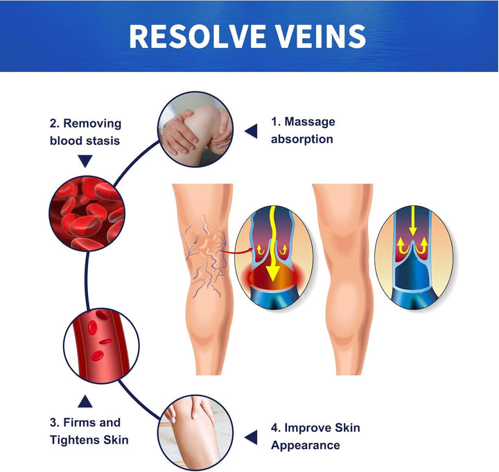 Leg Varicose Ointment,Varicose Vein Gel,Varicose Vein Removal Cream,Vein Relief Cream for Pain Relief, Natural Varicose,20G