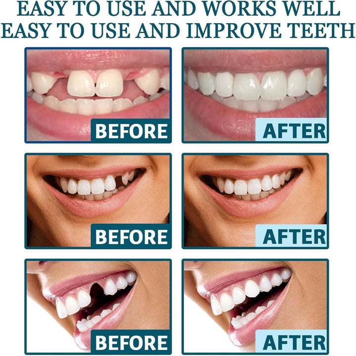 1 Pair of Denture Repair Kit,False Teeth Set,Clip in Veneers Teeth,Soft Denture Reline Kit,Denture Kit for Repair Missing Teeth,Dentures False Teeth Set for Adults,Comes with 7 Red Wax Sheets