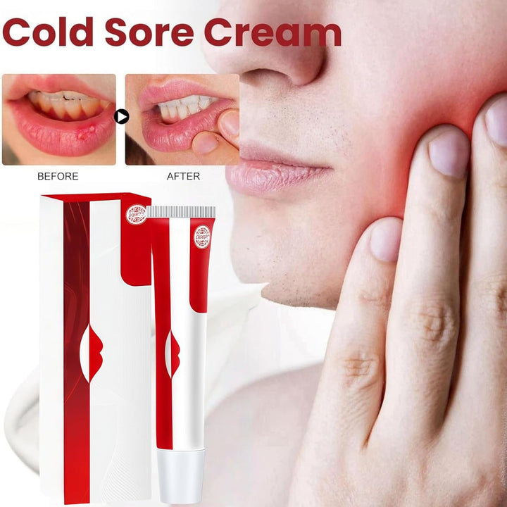 Cold Sore Cream,Gentle Cold Sore Treatment Cream,Mouth Ulcer Treatment for Adults,Gentle Sore Lips Treatment,Mouth Sore Treatment for Women and Men,Mouth Ulcer Gel,Pain Relief,Natural Ingredients