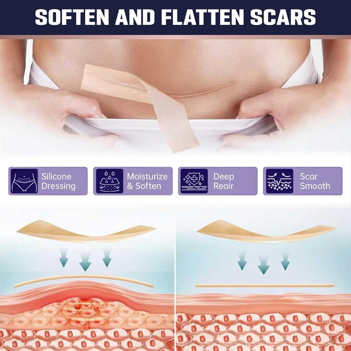 Silicone Scar Tape 4Cm X 1.5M | Medical Grade Silicone Sheets for Scar Care | Suitable for Surgery, C Section, Burns, Acne Marks and Stretch Marks | Soft, Reusable, Waterproof