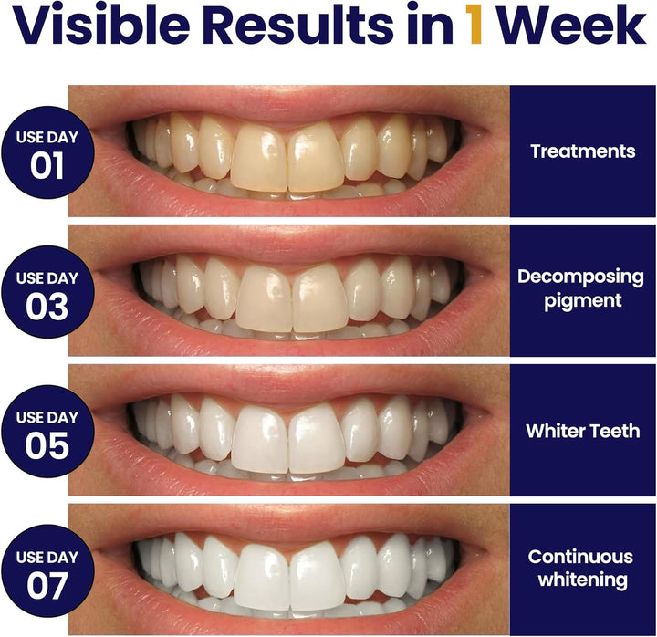 Professional Teeth Whitening Strips,28 Non-Sensitive, Safe for Enamel, anti Slip, Dentist Formulated Teeth Whitener Strips, Adavance Pap Whitening Stripes