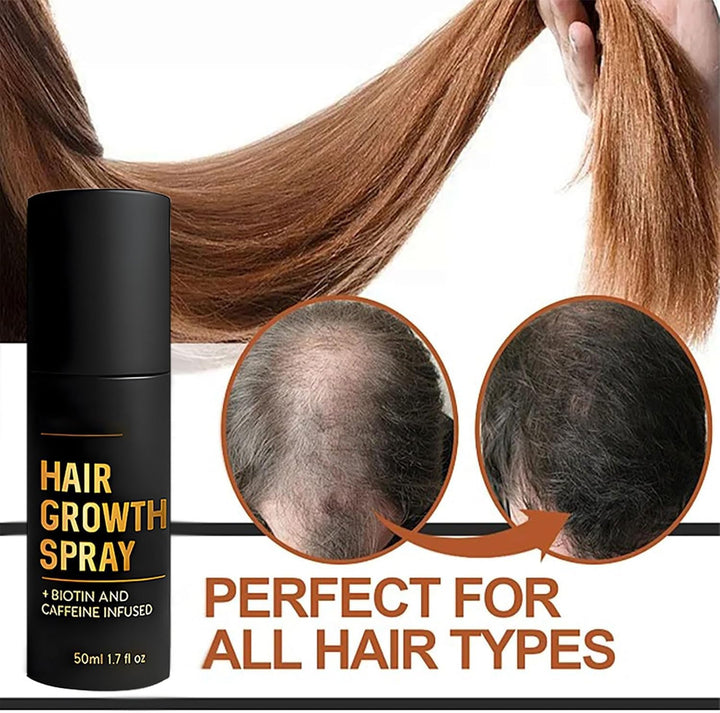 Hair Growth Spray, Biotin Hair Thickening Spray for Thinning Hair, Supports Fuller & Stronger Hair for Women & Men (1)