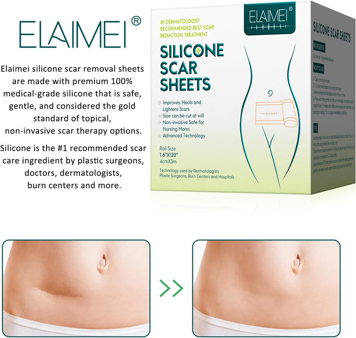 Silicone Scar Sheets, Silicone Scar Tape (1.6” X 120”Roll-3M), Scar Tape Roll Medical Silicone Easy-Tear Gel Tape Roll, Scar Removal Sheets Works on Old & New Scars, Scar Treatment Sheets