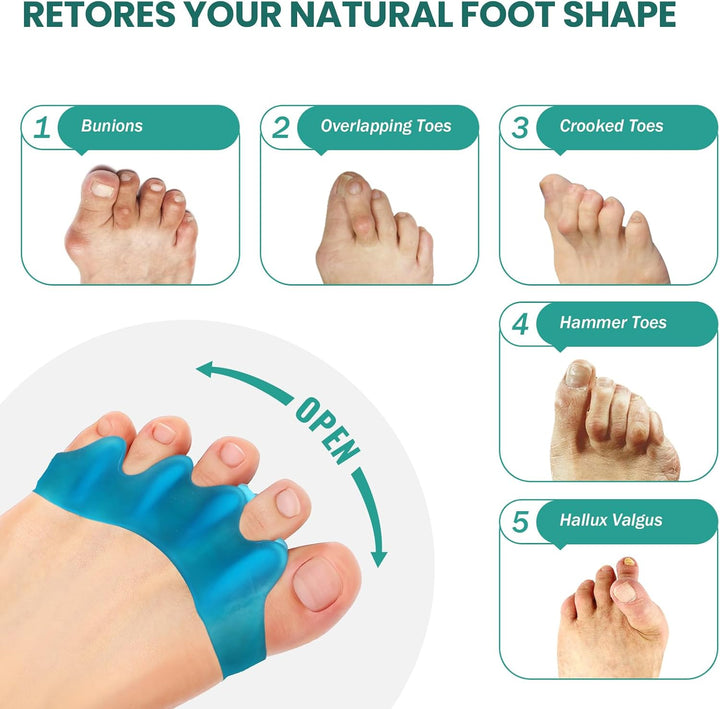8 Pack Toe Separators, Bunion Corrector for Women/Men, Toe Spacers, Foot Alignment - Dividers to Correct Bunions, Hammertoes, Relief Restore Feet (Blue)
