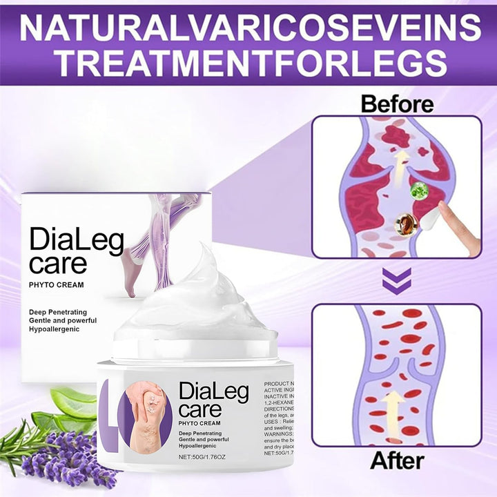 Dialeg Care Varicose Relief Veins Cream - Varicose Veins Treatment for Legs - V-Ein Cream Improve the Look of Legs - Natural Ourlyard C-Ream, Deep Penetrating, Hypo-Allergenic for All Skin