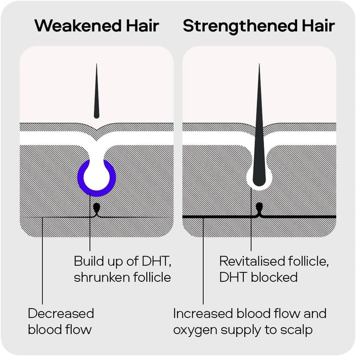 Hair Growth Shampoo for Men. DHT Blocker. Thickening Formula Promotes Strong & Thick Regrowth. Contains Saw Palmetto, Argan Oil, Caffeine, & Rosemary. 3 Month Supply. Made in Europe.