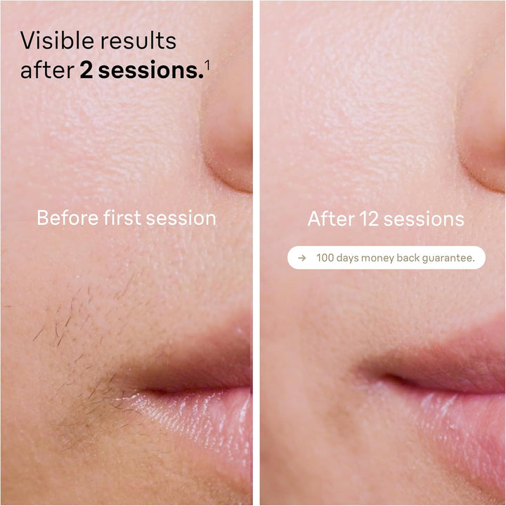 IPL Silk-Expert Pro 5, at Home Hair Removal, Alternative for Laser Hair Removal, Includes Pouch, Venus Razor, Precision Head, 2 Years of Smooth Skin, Gift for Women, White/Gold, PL5138