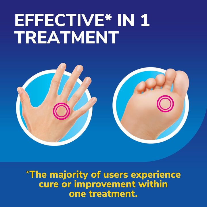 Freeze Away Max Verruca and Wart Remover for Hands and Feet - as Fast as 10 Seconds to Treat Warts and Verrucas, Safe for Children Aged 4 and Above