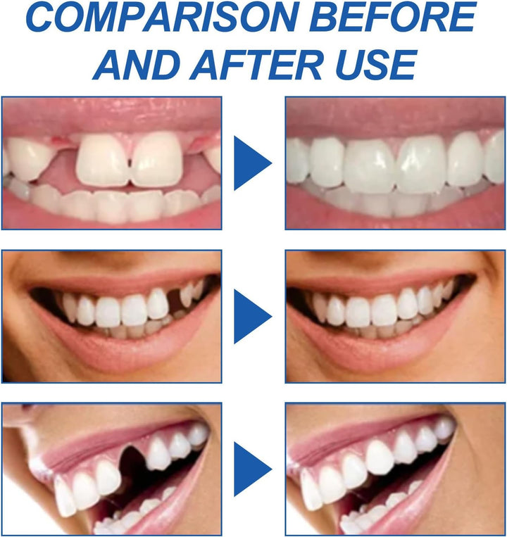 Tooth Filling Repair Kit, Temporary Tooth Filling & Moldable False Teeth Repair Kit – Dental Repair Beads to Replace Missing or Broken Teeth, Halloween False Teeth