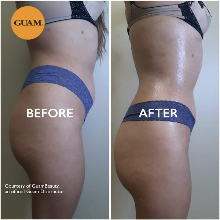 Seaweed Mud Stubborn & Deeply Rooted anti Cellulite Treatment - 500G Antioxidant Hot Body Mask Cellulite Remover for Legs & Thighs - Skin Firming Cream to Reduce Imperfections & Boost Circulation