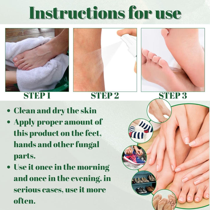 1Pcs Athlete'S Foot Spray 30Ml - Fast-Acting anti Fungal Spray for Foot Fungus Treatment, Feet Deodorant for Smelly Feet, Athlete'Sfoot Treatment with Natural Ingredients and Moisturising