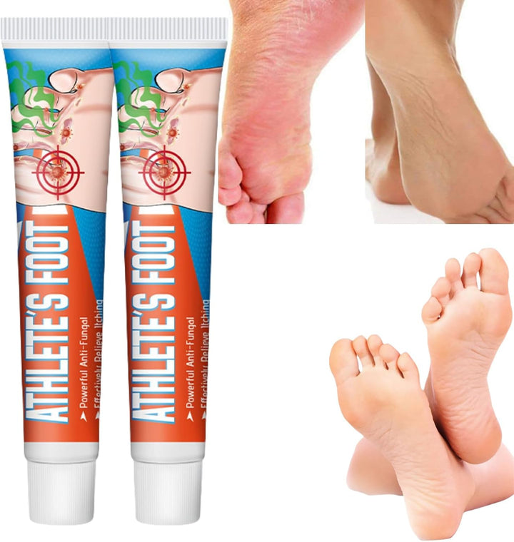 2PCS Athletes Foot Treatment,Anti Fungal Skin Cream,Antifungal Cream for Effective Anti-Itch,Itch Relief Cream,Foot Fungus Treatment,Itchy Skin Relief for Adults,Athletes Foot Cream Extra Strong