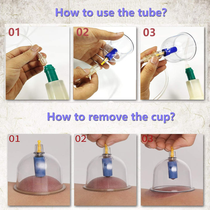 12 Cupping Cups Sets Biomagnetic Traditional Professional Chinese Therapy Massage Cupping Set Household Pull Out Vacuum Cupping Kit/Chinese Massage Hijama Suction (12)