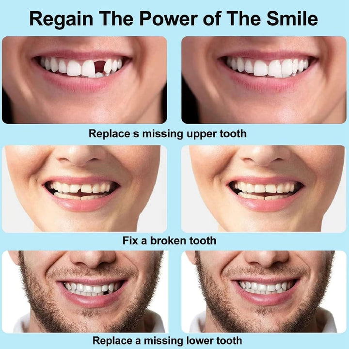 Temporary Tooth Filling,Repair Beads Tooth Filling Repair Kit,False Teeth,Moldable Tooth Repair Kit,Thermal Forming Filling Kit for Teeth,Tooth Repair Granules,Diy Fixing Dental Bridge Repair Kit