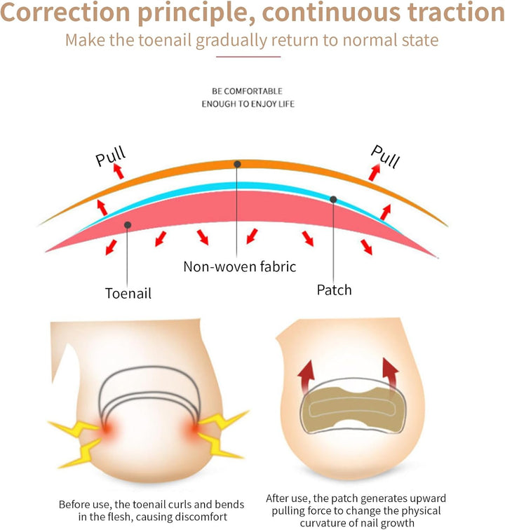2 Types Ingrown Toenail Treatment Patch with Ingrown Toenail Tool for Toenail Care Protect Toe Nail