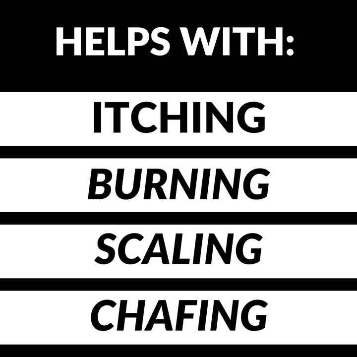 Jock Itch Treatment for Women - Antifungal Cream, Skin Jock Itch Treatment anti Fungal Soothing Cream - Maximum Strength - Made in the UK - All Natural (30Ml) by