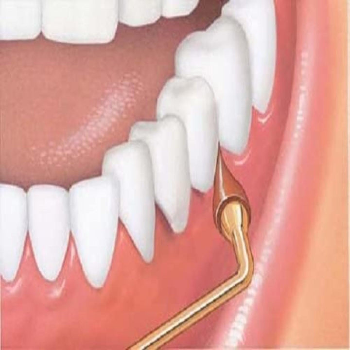 Stimulateur Gingival