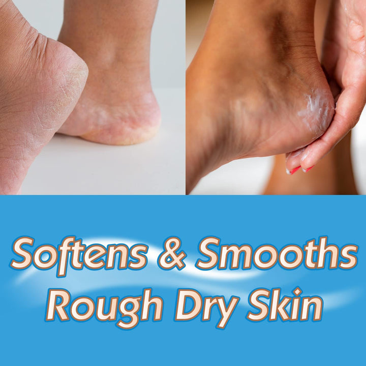 Heel Balm, Soften for Relief & Comfort, Ready to Use, 70G