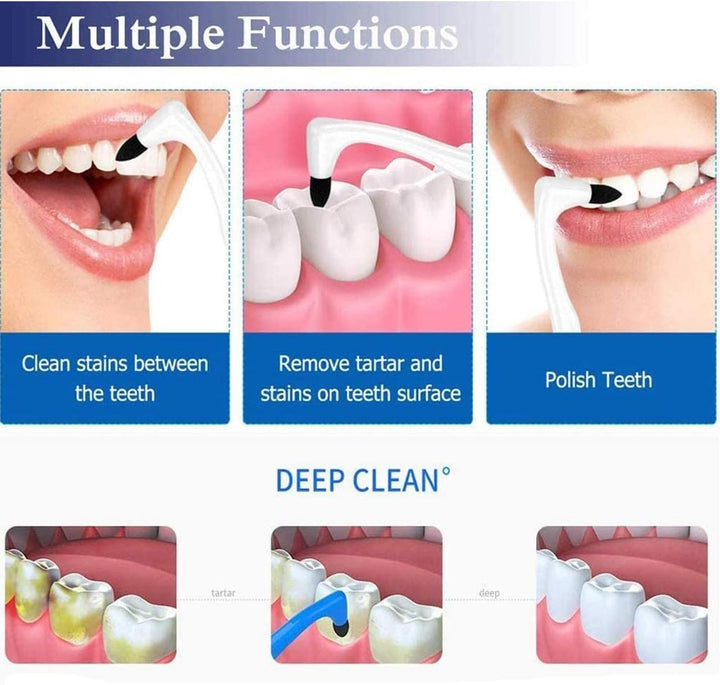 2PCS Tartar Remover Tooth Stain Eraser, Teeth Polishing/Cleaning Kit Removes Plaque & Impurities (White & Blue)