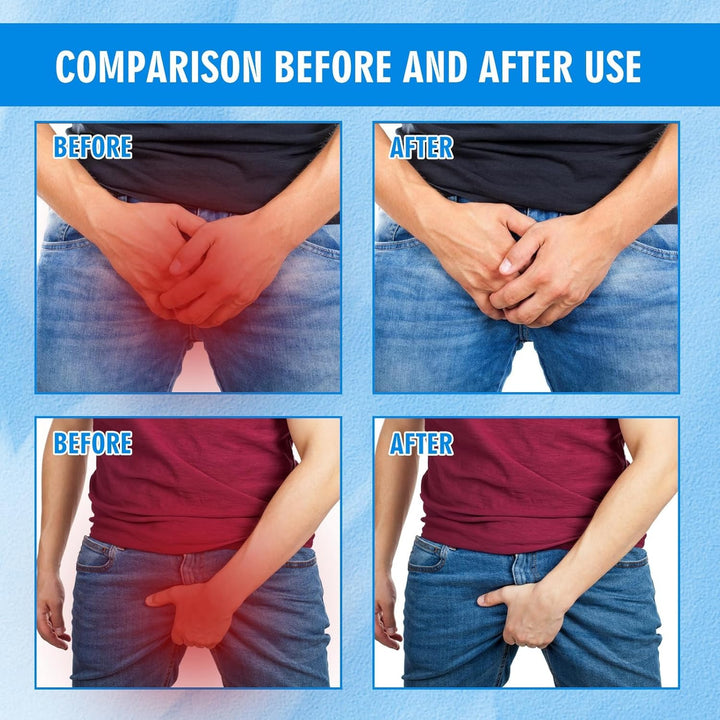 Anti-Fungal Cream for Men and Women,Cream for Private Parts,Anti/Fungal anti Ttch Cream,Quickly Relieve Itching,Anti-Fungal Cream for Quick Itching,External Cream for Men and Women,Anti/Fungal Cream